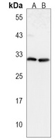 CTHRC1 Antibody
