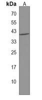 ARPC1B Rabbit Polyclonal Antibody