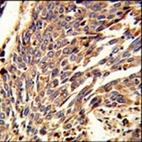 ARPC1B Rabbit Polyclonal Antibody