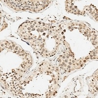 HSPA7 Rabbit Polyclonal Antibody