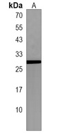 FNDC5 Rabbit Polyclonal Antibody