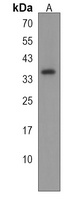 TSPAN12 Rabbit Polyclonal Antibody