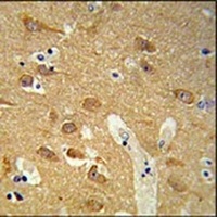 TSPAN12 Rabbit Polyclonal Antibody