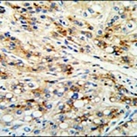CECR5 Rabbit Polyclonal Antibody