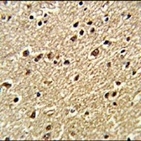 ZNF823 Rabbit Polyclonal Antibody