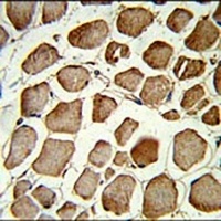 PLEKHO1 Antibody