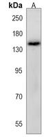 NEK1 Rabbit Polyclonal Antibody