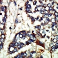 NEK1 Rabbit Polyclonal Antibody
