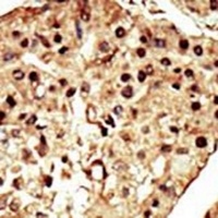 TRPM7 Rabbit Polyclonal Antibody