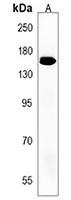 TNIK Rabbit Polyclonal Antibody