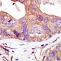 PKN2 Antibody