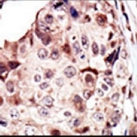 RYK Rabbit Polyclonal Antibody