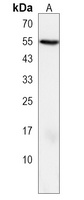 CLIC5 Rabbit Polyclonal Antibody