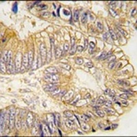 CLIC5 Rabbit Polyclonal Antibody