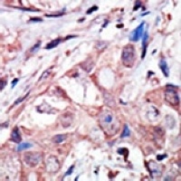 JNK3 Rabbit Polyclonal Antibody