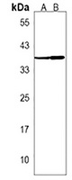 EN2 Rabbit Polyclonal Antibody