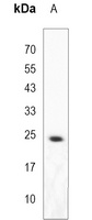 MOB1A Rabbit Polyclonal Antibody
