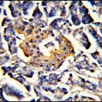 SRP72 Rabbit Polyclonal Antibody