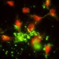 SRP72 Rabbit Polyclonal Antibody