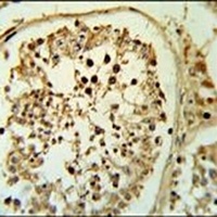 FSCN3 Rabbit Polyclonal Antibody