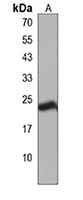 SPCS3 Rabbit Polyclonal Antibody