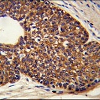 MTBP Rabbit Polyclonal Antibody