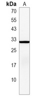 ARF3 Rabbit Polyclonal Antibody