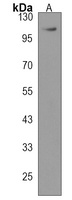 NPEPPS Rabbit Polyclonal Antibody
