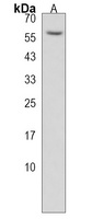 MMP17 Rabbit Polyclonal Antibody