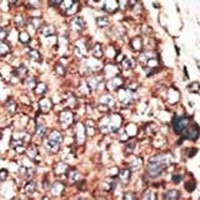 MMP17 Rabbit Polyclonal Antibody