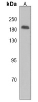 Adenylate Cyclase 10 Rabbit Polyclonal Antibody