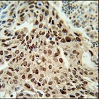 ERI3 Rabbit Polyclonal Antibody