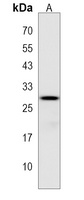 APOBEC2 Rabbit Polyclonal Antibody