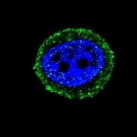 Calcitonin Receptor Rabbit Polyclonal Antibody