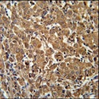 N4BP3 Rabbit Polyclonal Antibody