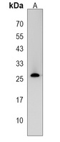 CRISPLD2 Rabbit Polyclonal Antibody
