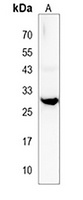 RYBP Rabbit Polyclonal Antibody