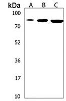 SUZ12 Rabbit Polyclonal Antibody