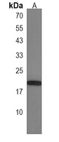 FAM168B Rabbit Polyclonal Antibody