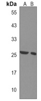 CHMP4A Rabbit Polyclonal Antibody