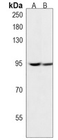 KDM1B Rabbit Polyclonal Antibody