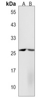 CXCL16 Antibody
