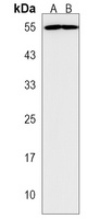 PPP2R2C Rabbit Polyclonal Antibody