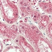 PRDM13 Rabbit Polyclonal Antibody