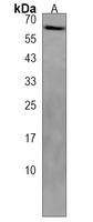 PET112 Rabbit Polyclonal Antibody