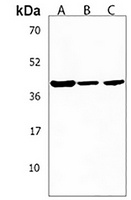 RAD9B Rabbit Polyclonal Antibody