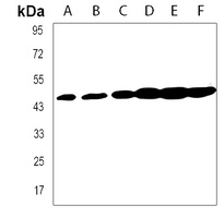 GDF11 Rabbit Polyclonal Antibody