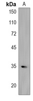 FBXL17 Antibody