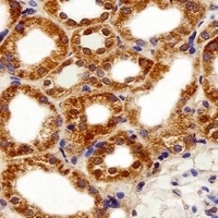 FBXL17 Antibody