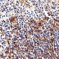 HLA-DRB1 Rabbit Polyclonal Antibody